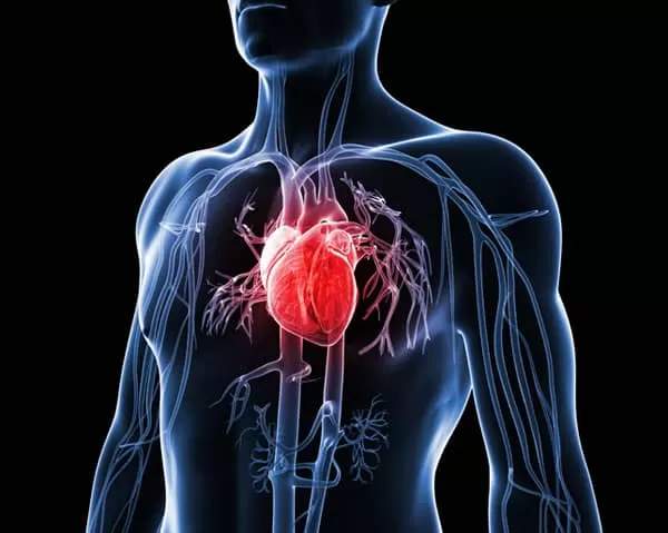 heart disease